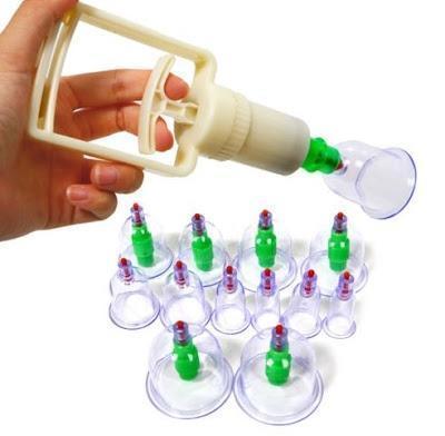 Set 12 ventuze medicinale terapeutice