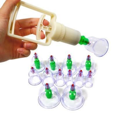 Set 12 ventuze medicinale terapeutice